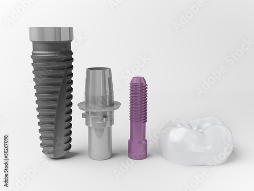 dental implant