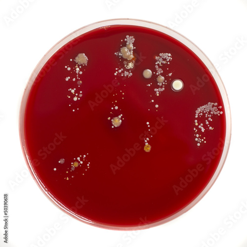 An agar plate with microorganisms photo