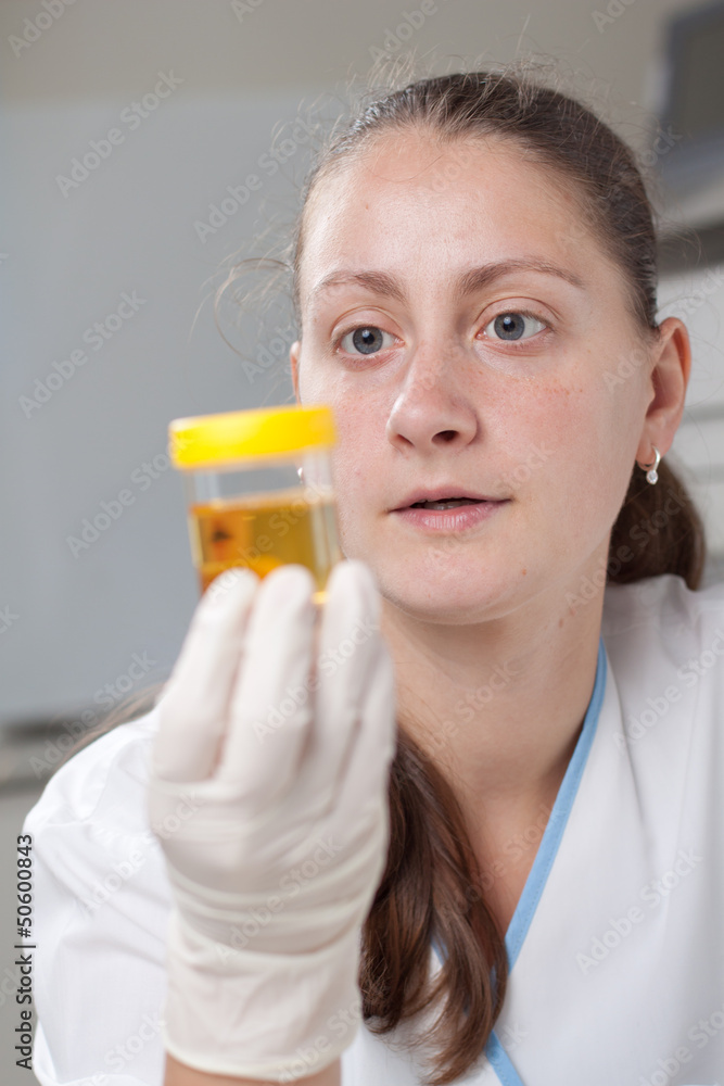 Woman examine urine container Woman examine urine container