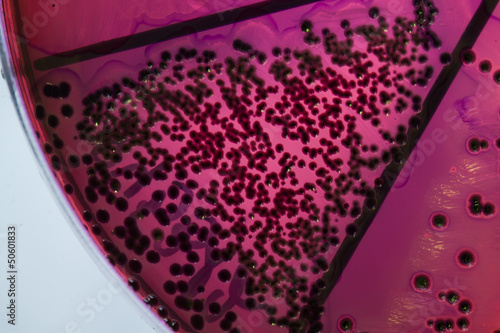 Bacteria on petri dish