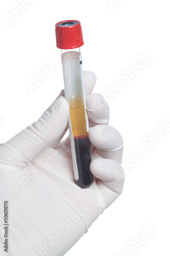Hand in glove with blood tube