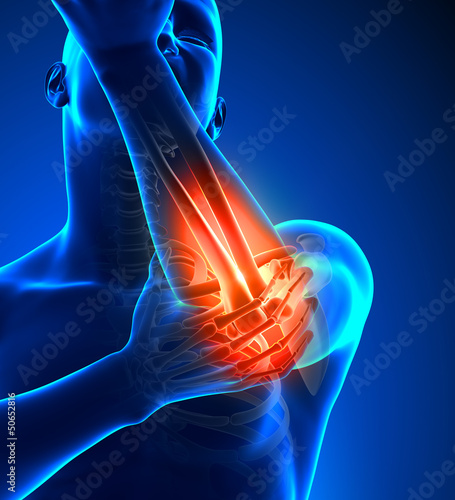Canvas Print Elbow Pain Male - Front view