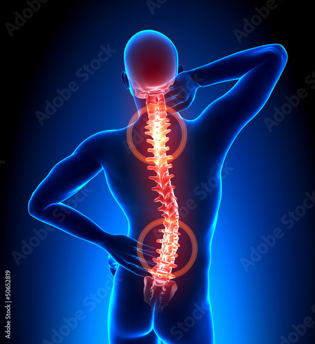 Male Hurt Backbone - Vertebrae Pain #50652819