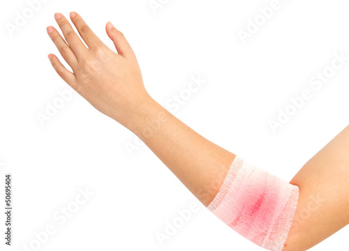 forearm and elbow injury ,strain ,sprained in white bandage