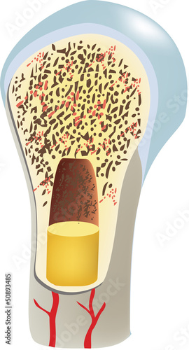osteoporosi