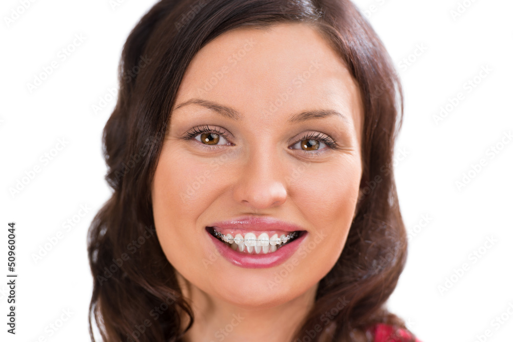 Closeup portrait of charming woman wearing orthodontic ceramic w Closeup portrait of charming woman wearing orthodontic ceramic w