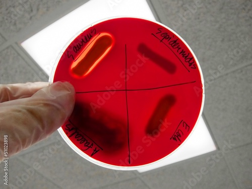 Bacterial pathogen colony colonies on blood agar streak plate