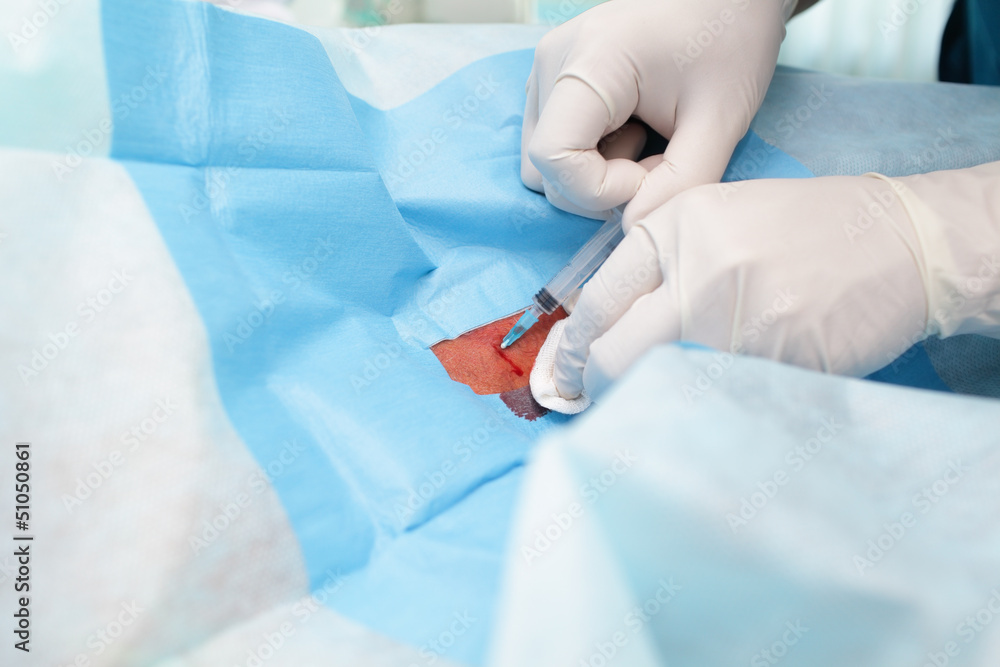 injection. work of the doctors and nurses. injection. work of the doctors and nurses.