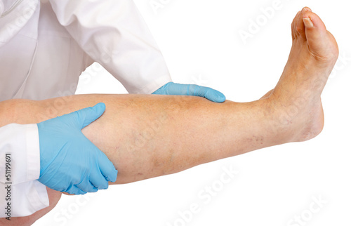 Lower limb examination photo