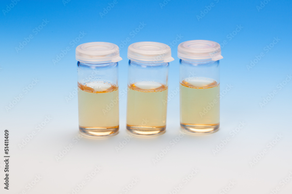 Three liquid samples in plastic vials. biological laboratory Three liquid samples in plastic vials. biological laboratory
