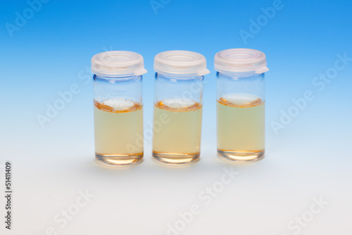 Three liquid samples in plastic vials. biological laboratory