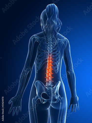 3d rendered medical illustration - backache