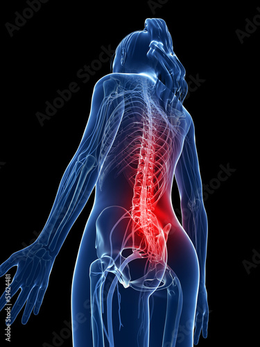 3d rendered medical illustration - backache photo