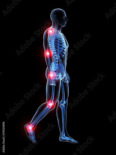 Bilde på lerret 3d rendered medical illustration - painful joints
