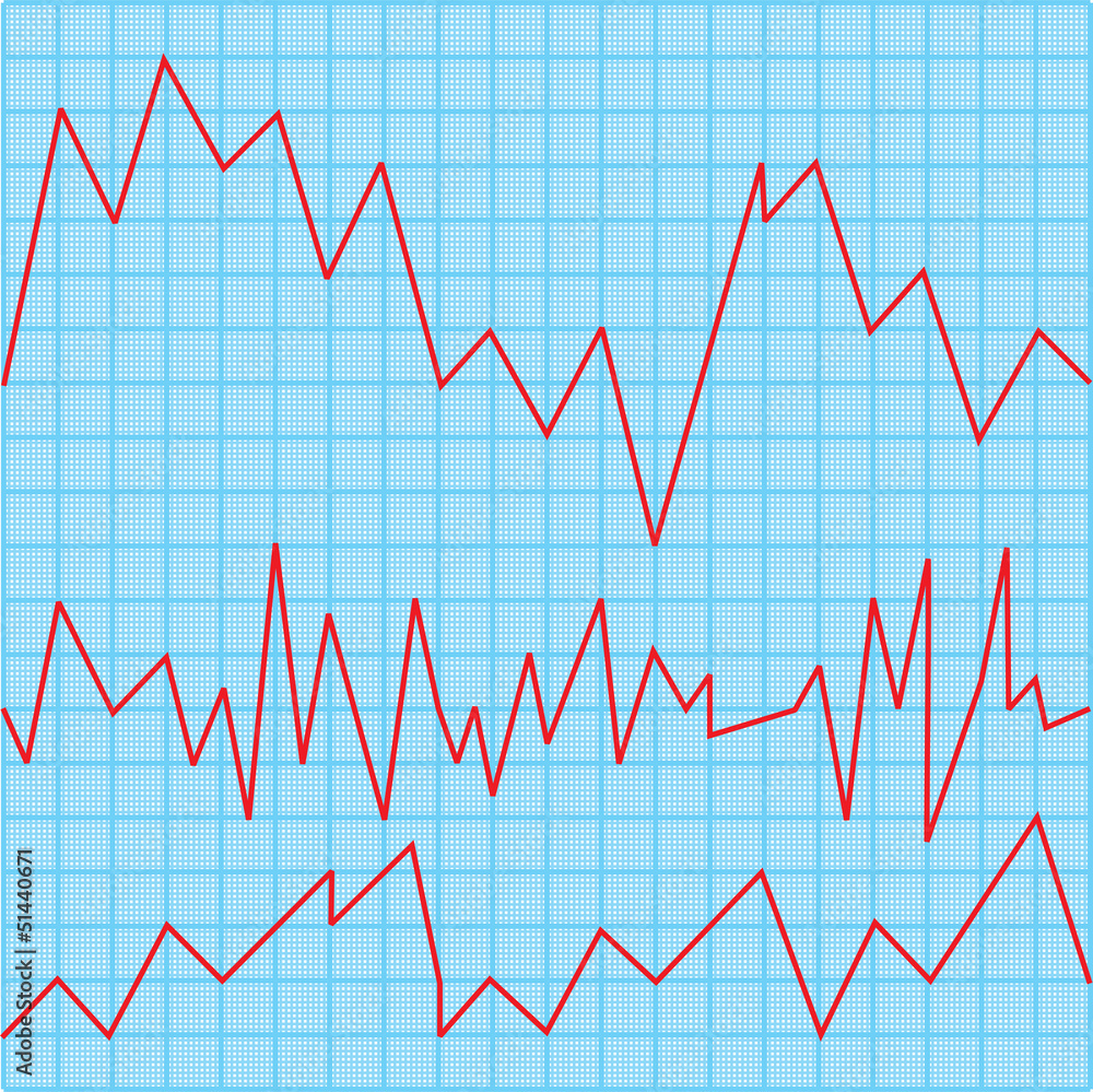 Cardiogram Cardiogram