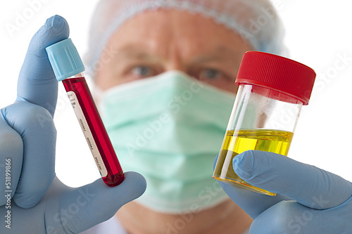 Fototapeta Analyse médicale - Sang & Urine