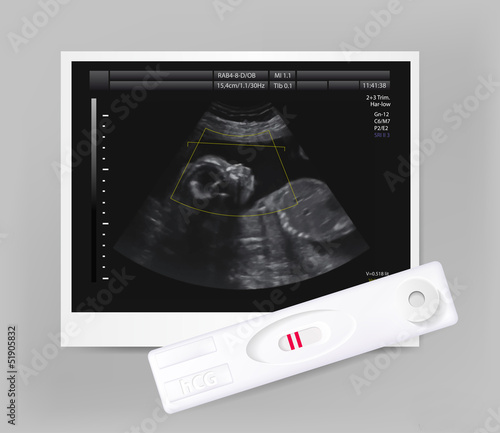 Ultrasound of baby in mother's womb and positive pregnancy test