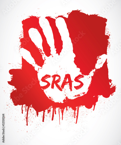 SRAS - syndrome respiratoire aigu sévère
