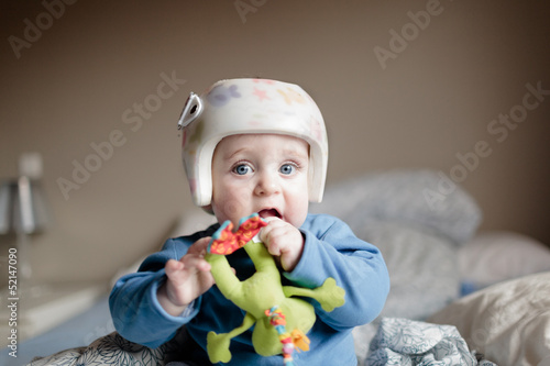 baby with helment for  Plagiocephaly