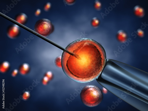 Εκτύπωση καμβά Intracytoplasmic sperm injection,In Vitro fertilization