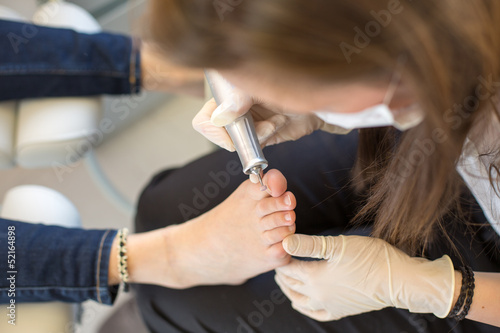 pedicure grinding toe nails