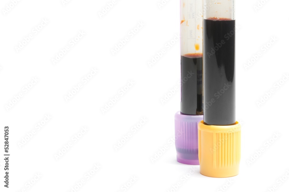 medical test tubes in laboratory with space for text medical test tubes in laboratory with space for text