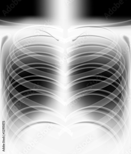 x-ray