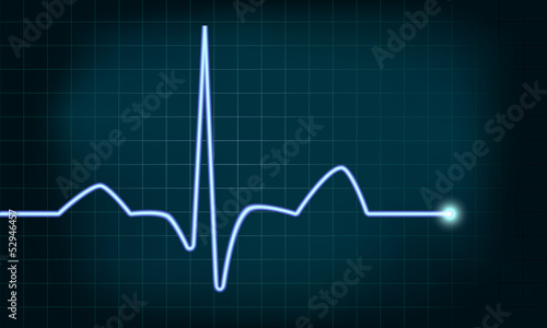 heartbeat curve