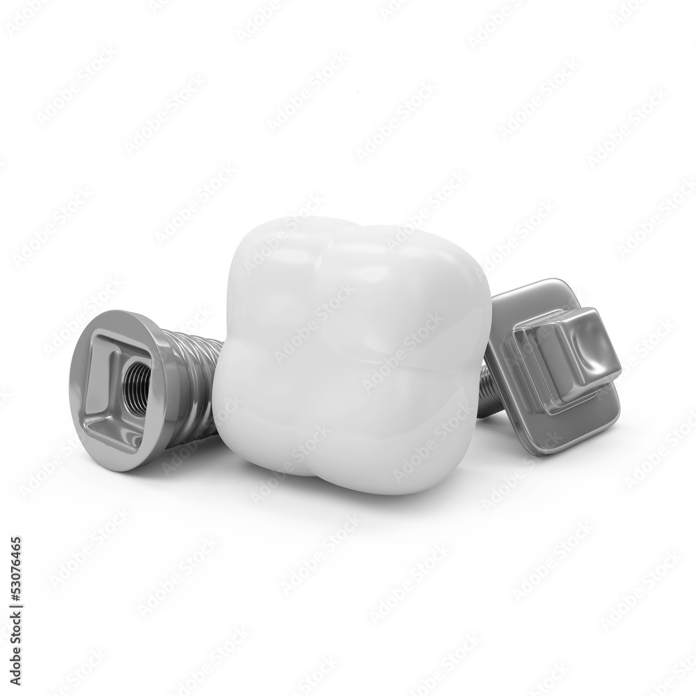Tooth Implant isolated on white background Tooth Implant isolated on white background