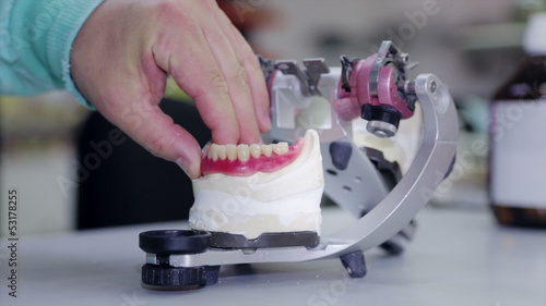 Dental prosthesis photo