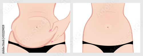 Jelly Belly before and after