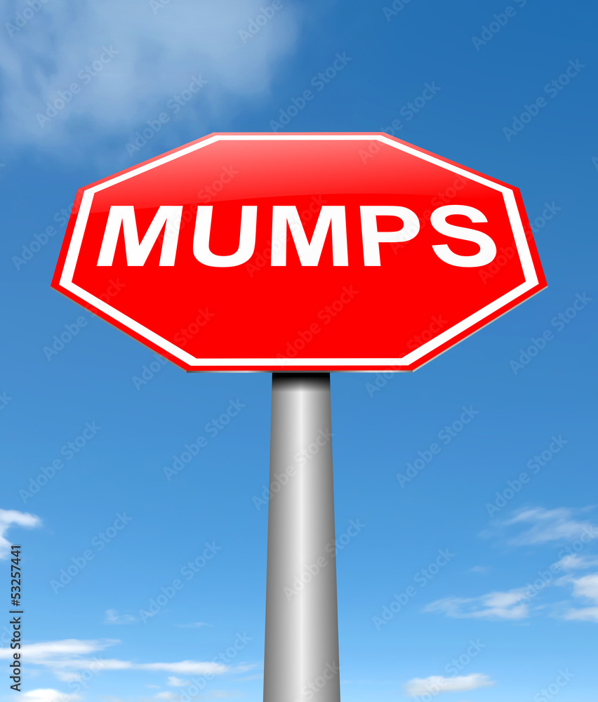 Mumps concept.