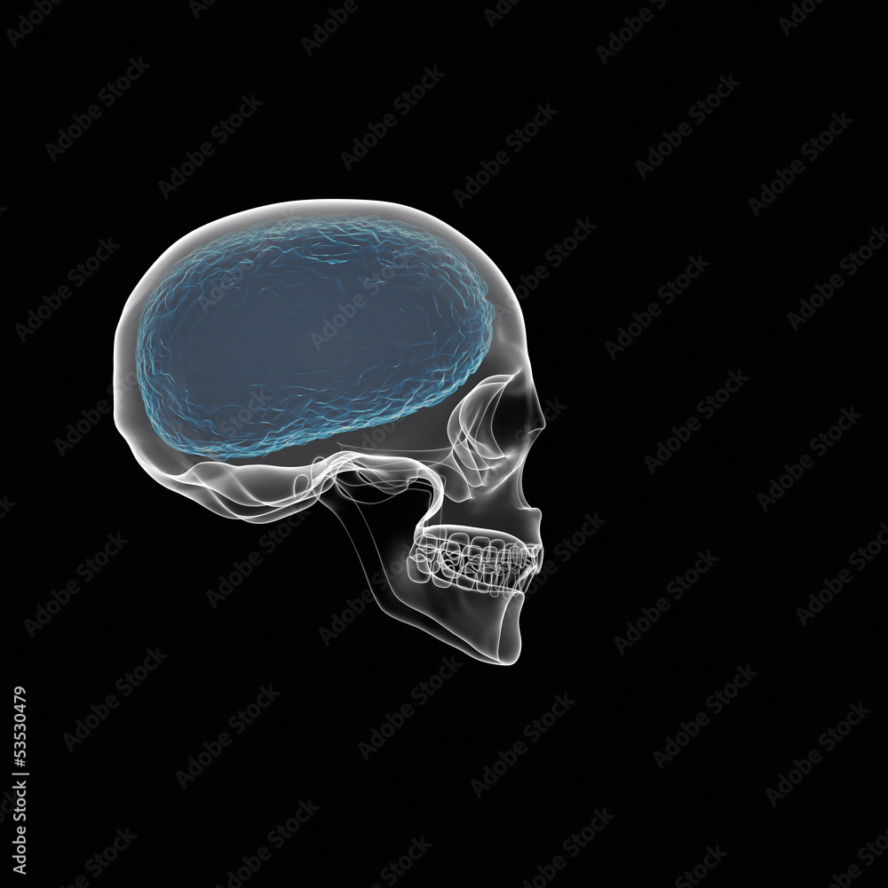 Human brain with skull x-ray view Stock Illustration | Adobe Stock
