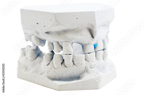 detailed macro of teeth molding photo