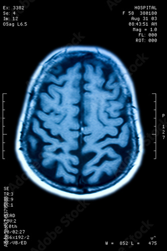 Coffee beans - Small