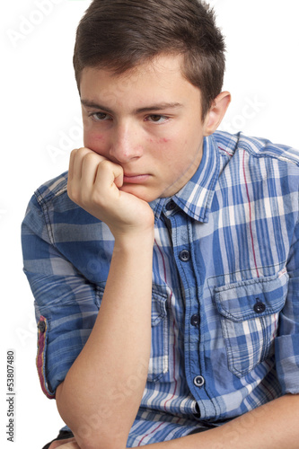 Teenage boy with acne problems