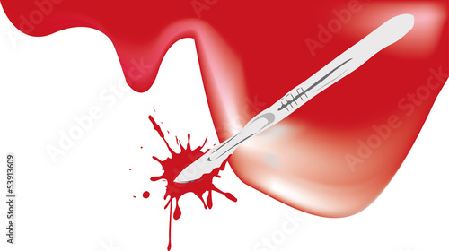Medical device Blood Lancet