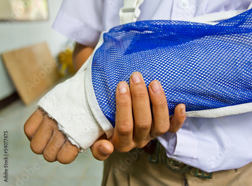 student's arm is broken