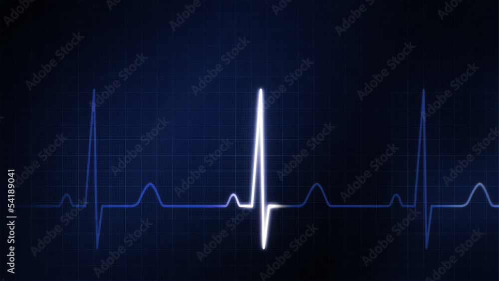 The blue graphic of EKG monitor