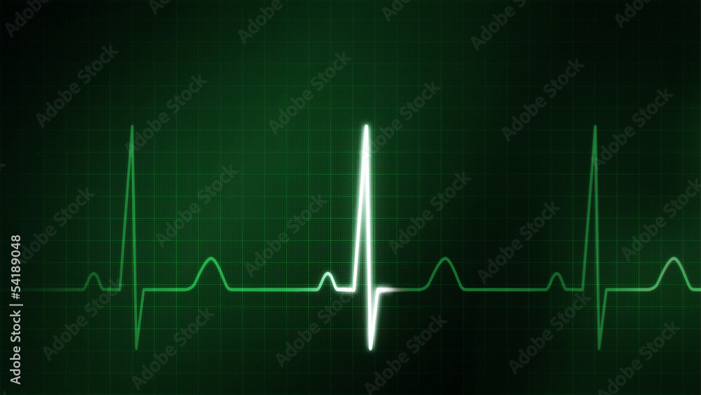 The green graphic of EKG monitor for medical theme