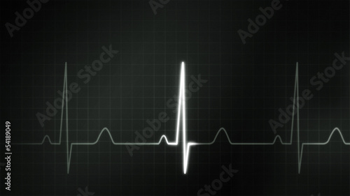 black and white graphic of EKG monitor