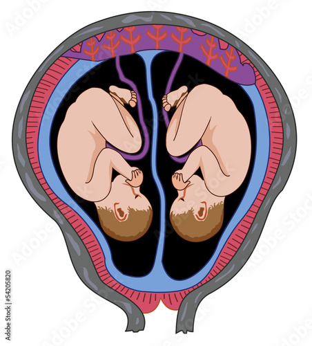 Twins in the womb
