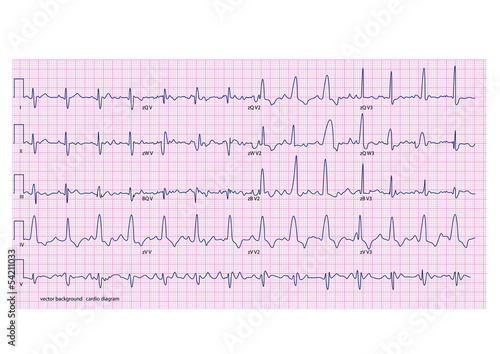 cardiogram