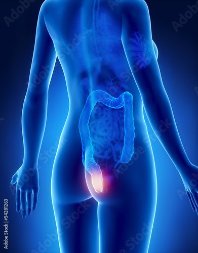 Female HEMORRHOIDS concept x-ray posterior view photo