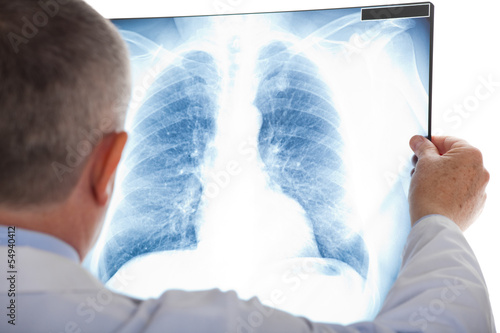 Doctor examining a lung radiography photo