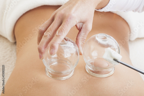 Close up of female therapist treating teenager patient with Chinese cupping acupuncture photo