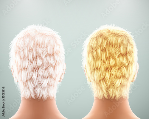 Back of head
