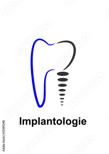 Logo Zahnimplantat