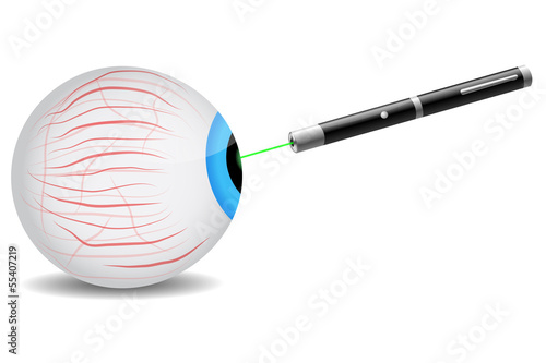 Laser on eye