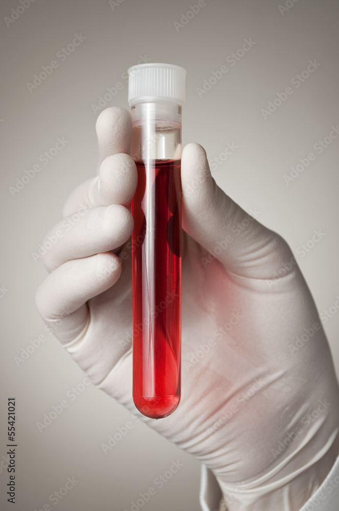 Doctor's hand with blood sample Doctor's hand with blood sample